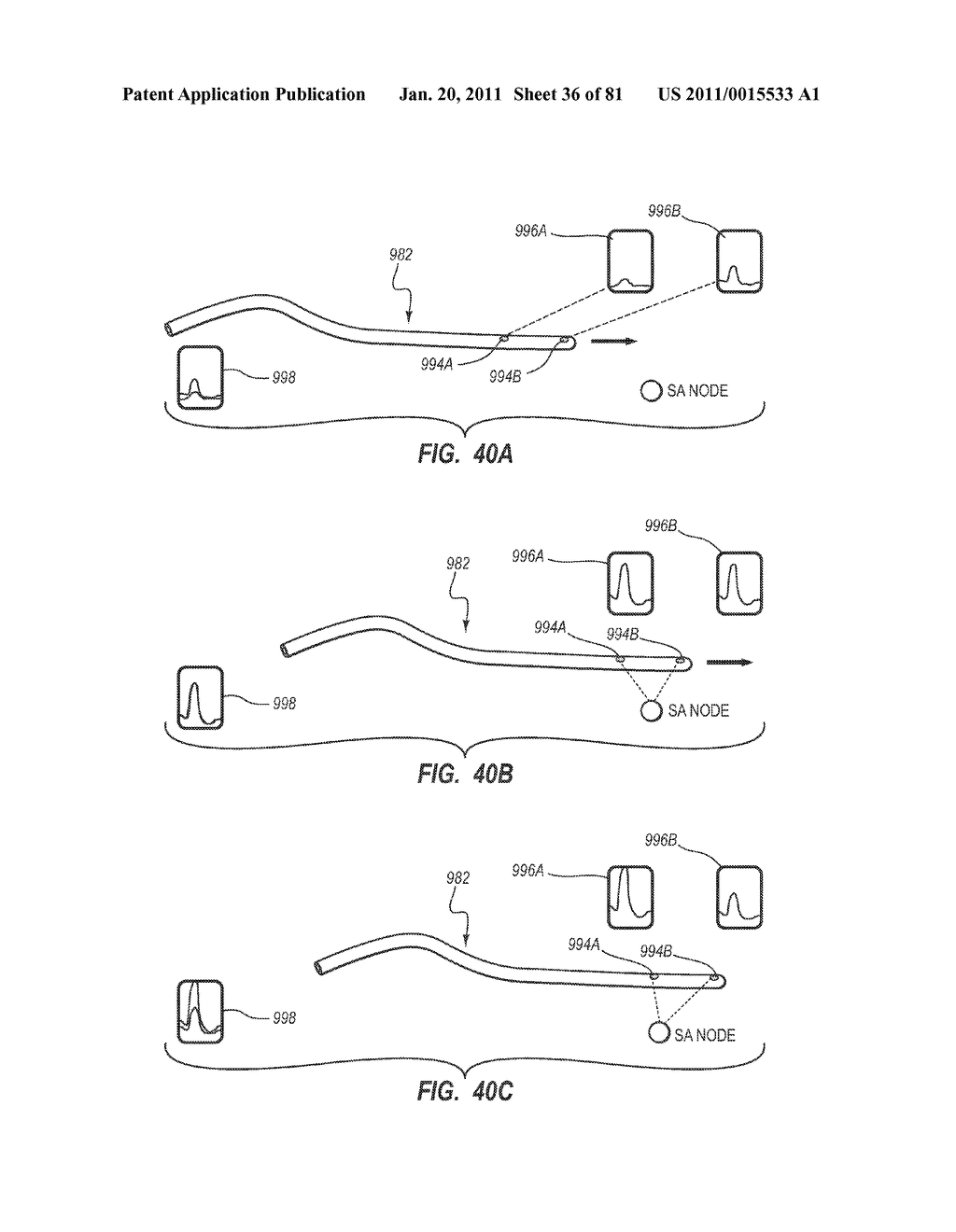 STYLETS FOR USE WITH APPARATUS FOR INTRAVASCULAR PLACEMENT OF A CATHETER - diagram, schematic, and image 37