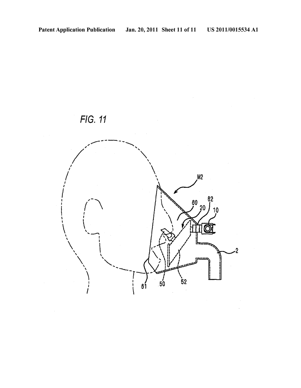 AIRWAY ADAPTOR - diagram, schematic, and image 12