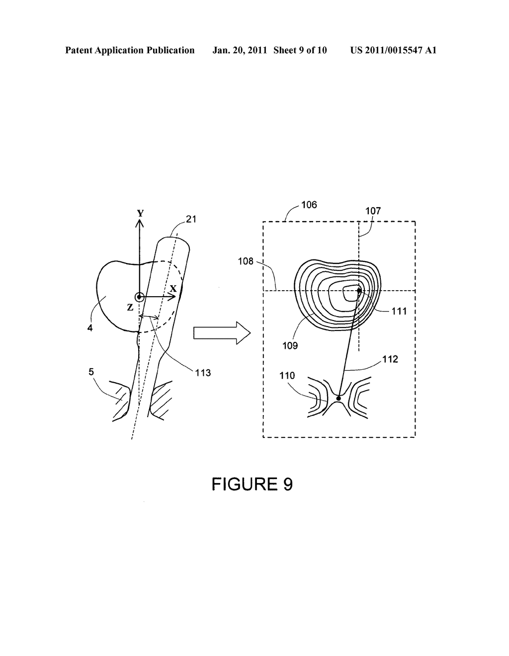 METHOD AND A DUAL-ARRAY TRANSDUCER PROBE FOR REAL TIME MECHANICAL IMAGING OF PROSTATE - diagram, schematic, and image 10