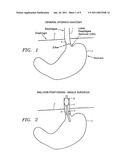 METHODS AND APPARATUS FOR TREATMENT OF OBESITY diagram and image