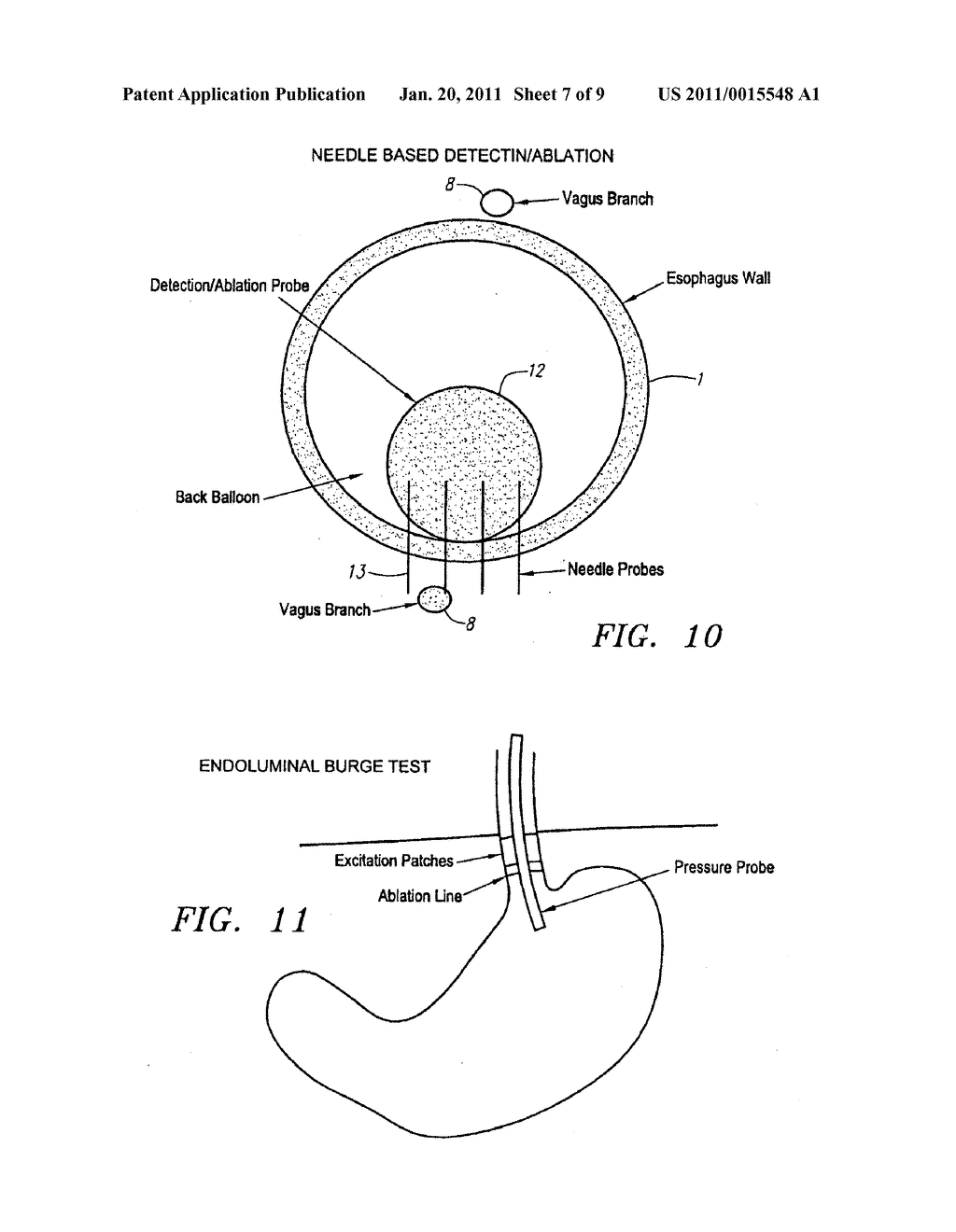 METHODS AND APPARATUS FOR TREATMENT OF OBESITY - diagram, schematic, and image 08