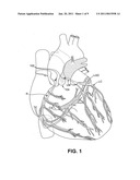 Isolating cardiac circulation diagram and image