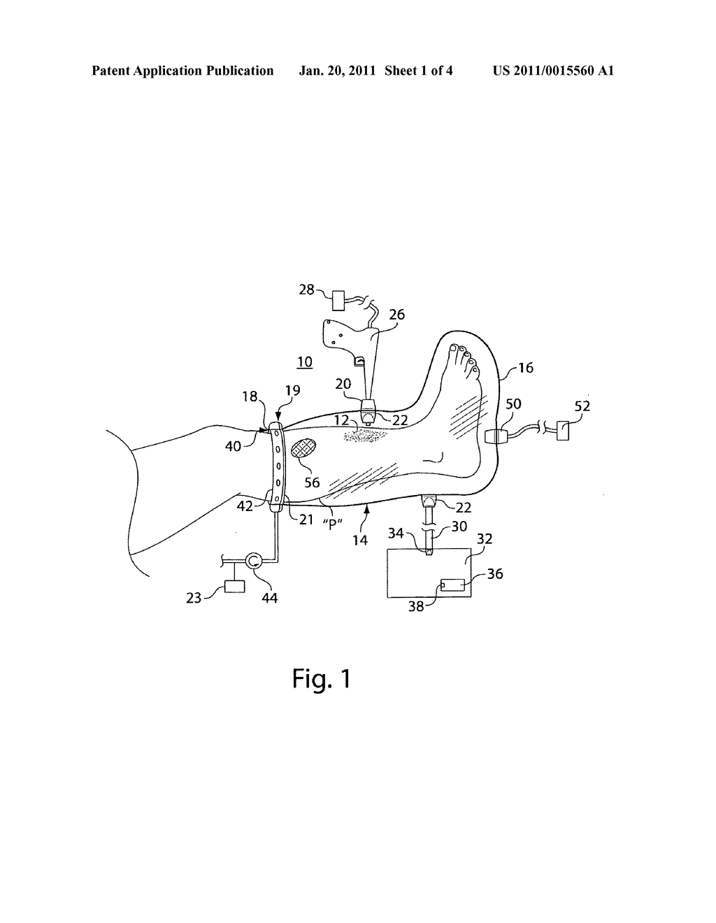 Wound irrigation containment arrangement - diagram, schematic, and image 02