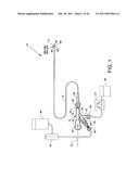 Direct Stream Hydrodynamic Catheter System diagram and image