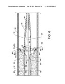 Direct Stream Hydrodynamic Catheter System diagram and image