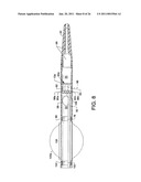 Direct Stream Hydrodynamic Catheter System diagram and image