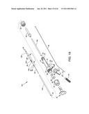 Direct Stream Hydrodynamic Catheter System diagram and image