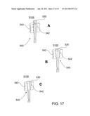 PREFILLED RETRACTABLE SYRINGE, PLUNGER AND NEEDLE ASSEMBLY diagram and image