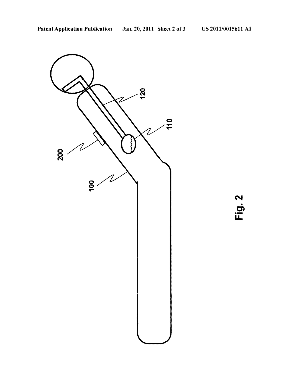 Aspiration prevention mechanism - diagram, schematic, and image 03