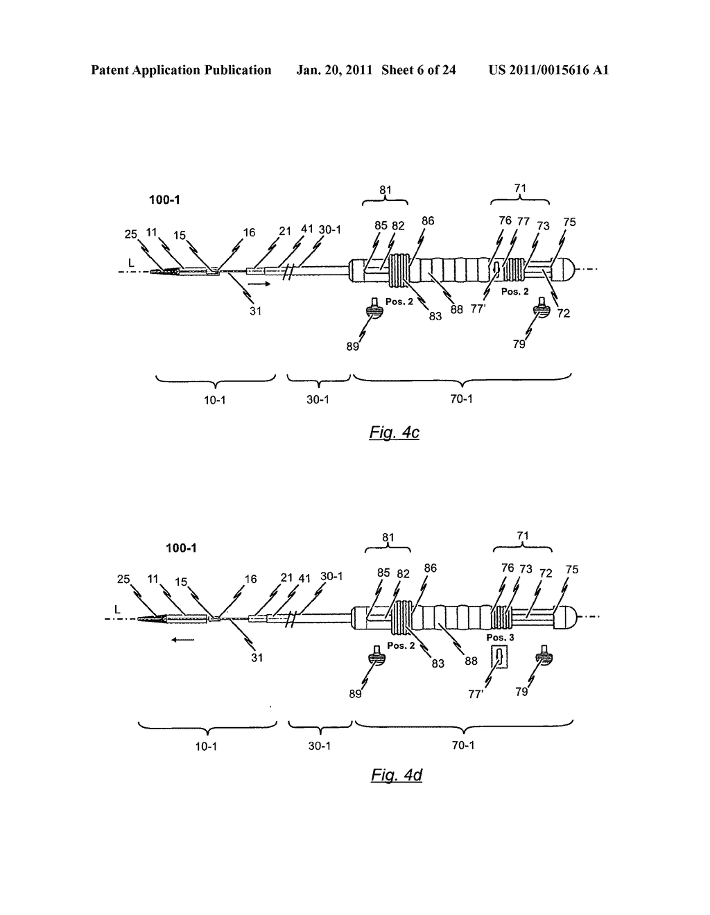 HANDLE FOR MANIPULATING A CATHETER TIP, CATHETER SYSTEM AND MEDICAL INSERTION SYSTEM FOR INSERTING A SELF-EXPANDABLE HEART VALVE STENT - diagram, schematic, and image 07