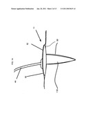 WOUND DRESSINGS FOR NEGATIVE PRESSURE THERAPY IN DEEP WOUNDS AND METHOD OF USING diagram and image