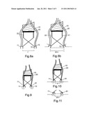 TENSIONING SYSTEM diagram and image