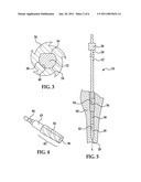 Modular Reaming System for Femoral Revision diagram and image