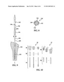 Modular Reaming System for Femoral Revision diagram and image