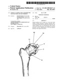 SURGICAL GUIDING TOOL, METHODS FOR MANUFACTURE AND USES THEREOF diagram and image