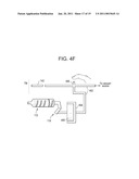 TYMPANIC MEMBRANE PRESSURE EQUALIZATION TUBE DELIVERY SYSTEM diagram and image