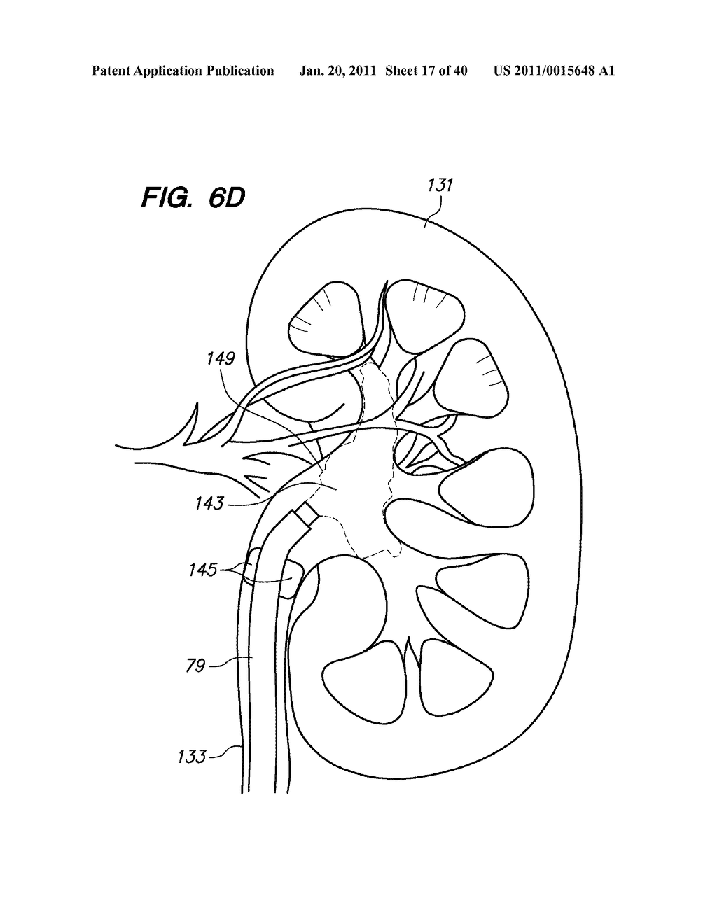 ENDOSCOPIC ROBOTIC CATHETER SYSTEM - diagram, schematic, and image 18