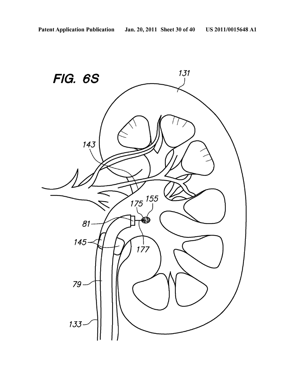 ENDOSCOPIC ROBOTIC CATHETER SYSTEM - diagram, schematic, and image 31