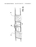 Device for assisting in flexor tendon repair and rehabilitation diagram and image