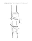 Device for assisting in flexor tendon repair and rehabilitation diagram and image