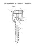 ANCHORING ELEMENT AND STABILIZATION DEVICE FOR THE DYNAMIC STABILIZATION OF VERTEBRAE OR BONES USING SUCH ANCHORING ELEMENTS diagram and image