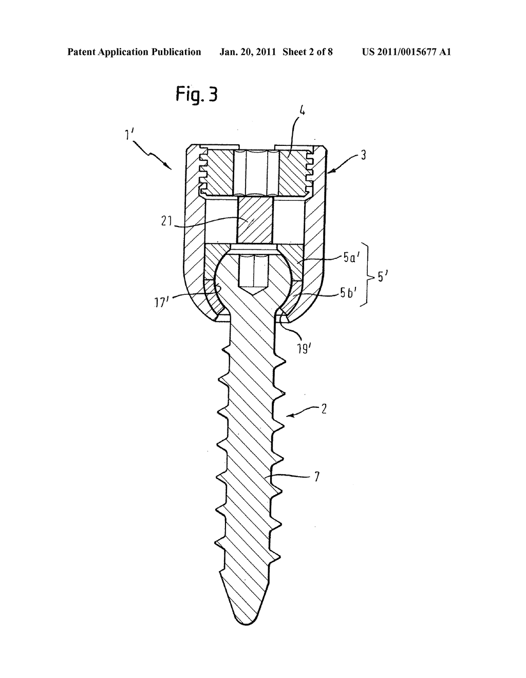 ANCHORING ELEMENT AND STABILIZATION DEVICE FOR THE DYNAMIC STABILIZATION OF VERTEBRAE OR BONES USING SUCH ANCHORING ELEMENTS - diagram, schematic, and image 03