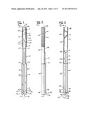 Spinal fixation tool set and method diagram and image