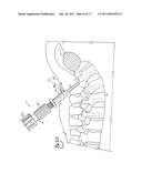Spinal fixation tool set and method diagram and image