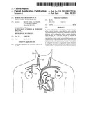 REMOTE PACE DETECTION IN AN IMPLANTABLE MEDICAL DEVICE diagram and image