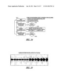 REMOTE PACE DETECTION IN AN IMPLANTABLE MEDICAL DEVICE diagram and image