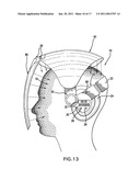 Phototherapy apparatus for hair, scalp and skin treatment diagram and image