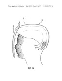 Phototherapy apparatus for hair, scalp and skin treatment diagram and image