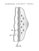 Phototherapy apparatus for hair, scalp and skin treatment diagram and image