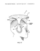 Phototherapy apparatus for hair, scalp and skin treatment diagram and image