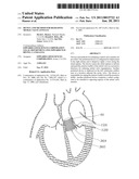 DEVICE AND METHOD FOR RESHAPING MITRAL VALVE ANNULUS diagram and image