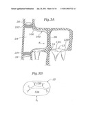 DEVICE AND METHOD FOR RESHAPING MITRAL VALVE ANNULUS diagram and image