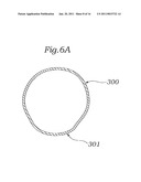 DEVICE AND METHOD FOR RESHAPING MITRAL VALVE ANNULUS diagram and image