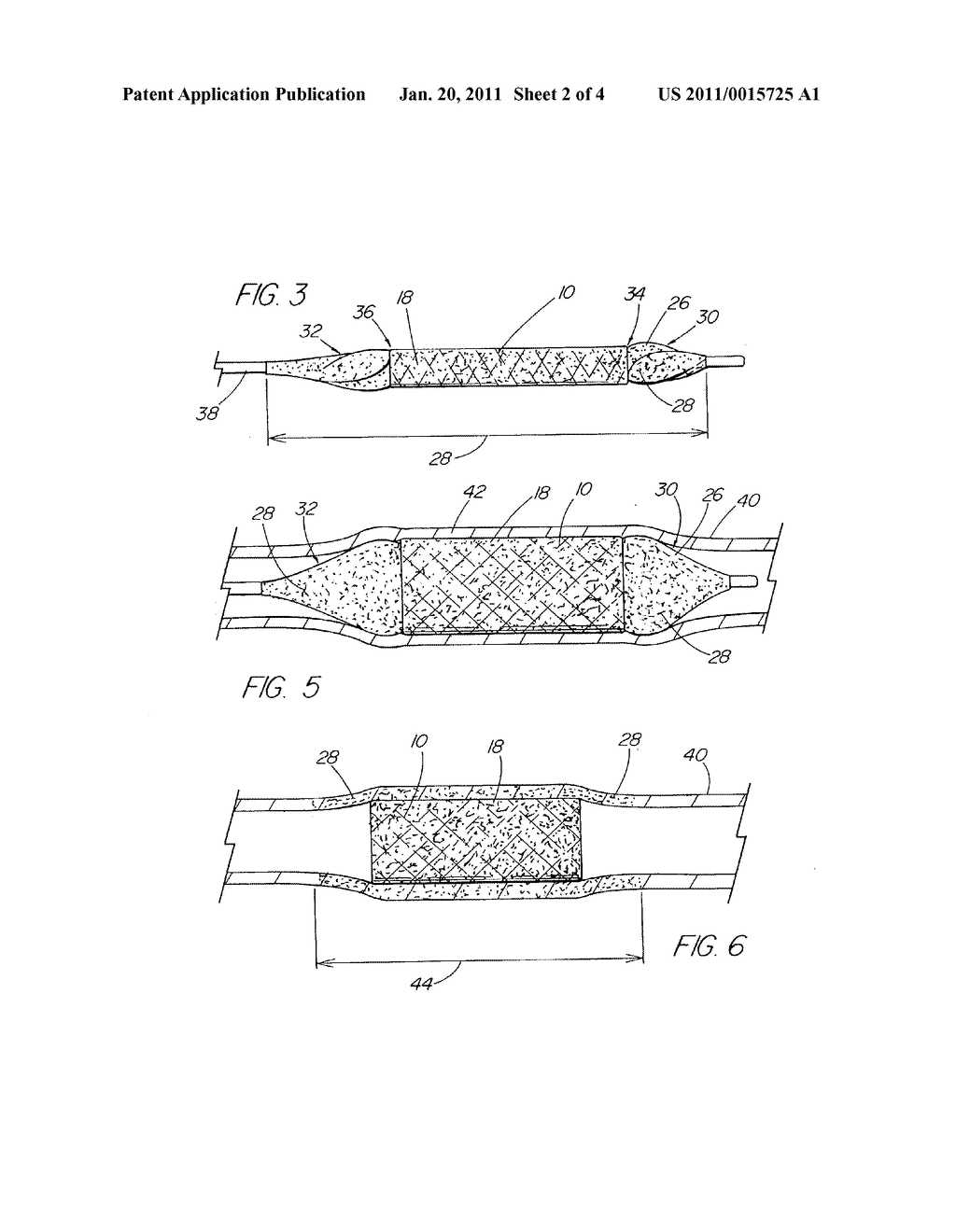 COATED MEDICAL DEVICE - diagram, schematic, and image 03