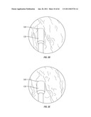 Methods for Providing Therapy to an Anatomical Structure diagram and image