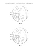 Methods for Providing Therapy to an Anatomical Structure diagram and image