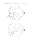 Methods for Providing Therapy to an Anatomical Structure diagram and image