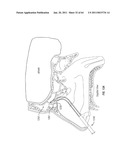 Methods for Providing Therapy to an Anatomical Structure diagram and image