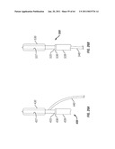 Methods for Providing Therapy to an Anatomical Structure diagram and image