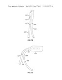 Methods for Providing Therapy to an Anatomical Structure diagram and image