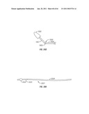 Methods for Providing Therapy to an Anatomical Structure diagram and image