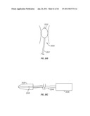 Methods for Providing Therapy to an Anatomical Structure diagram and image