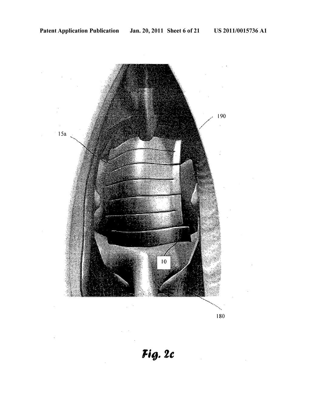 Temporary Implantable Medical Device - diagram, schematic, and image 07