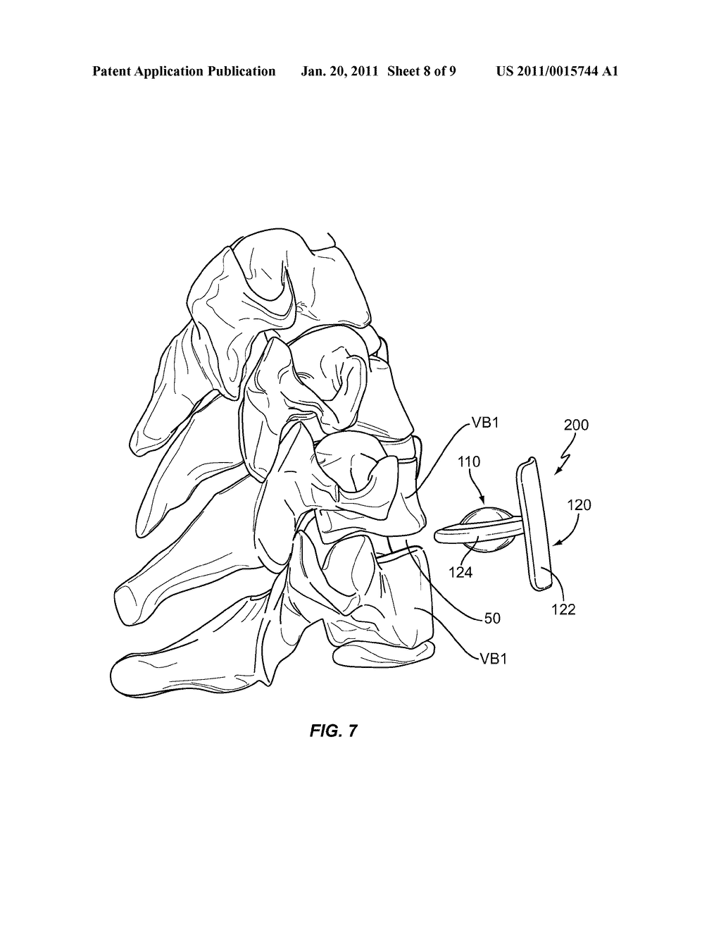 PROSTHETIC SPINAL DISC SYSTEM - diagram, schematic, and image 09