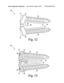 Combined Spinal Interbody and Plate Assemblies diagram and image