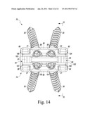 Combined Spinal Interbody and Plate Assemblies diagram and image